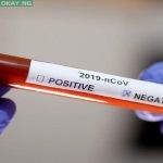 Coronavirus (COVID-19) negative